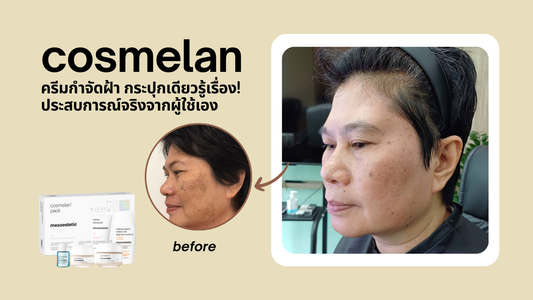 cosmelan ครีมกำจัดฝ้า กระปุกเห็นผล! ประสบการณ์จริงจากผู้ใช้เอง