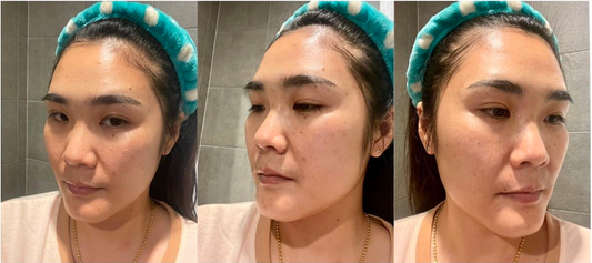 รีวิวเยอะ ก็จัดมาลองซะหน่อย ลดฝ้า ผิวหน้ากระจก cosmelan home pack