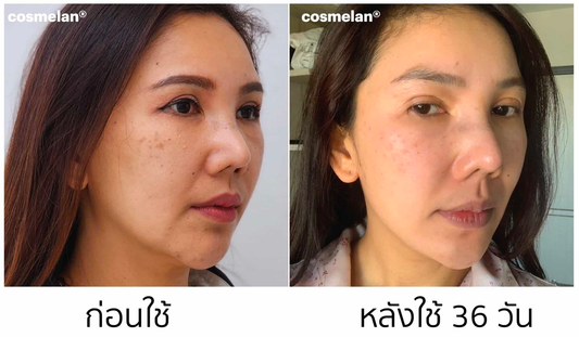 ความสวยไม่คงที่ cosmelan ที่ว่าดีต้องซื้อมาใช้