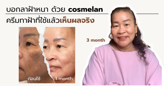 บอกลาฝ้าหนา ด้วย cosmelan ครีมทาฝ้าที่ใช้แล้วเห็นผลจริง