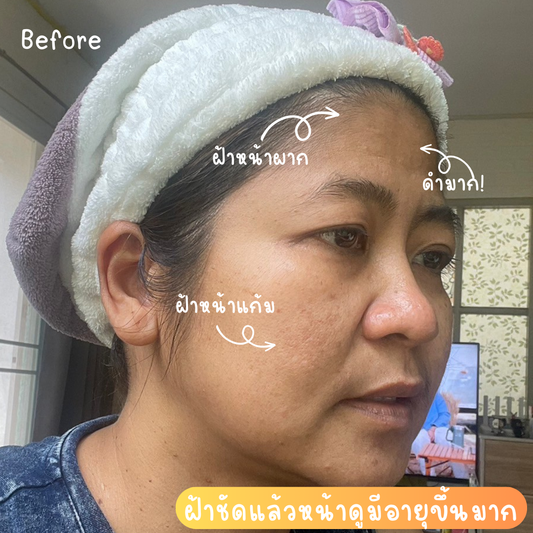 ทำบุญสวยชาติหน้า ใช้ “cosmelan” ปราบฝ้าสวยชาตินี้