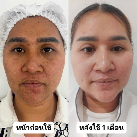 อย่าคิดว่าตัวเองไม่สวย ถ้ายังไม่ได้ใช้ cosmelan