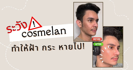 ระวัง!! ครีม cosmelan