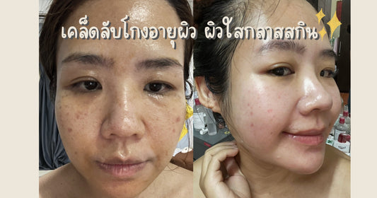 เคล็ดลับโกงอายุผิว ผิวใสกลาสสกิน