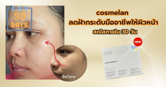 Cosmelan: ลดฝ้ากระดับมืออาชีพให้ผิวหน้าสดใสภายใน 30 วัน