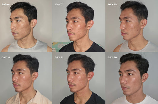 cosmelan สูตรเก่ากับสูตรใหม่ มีอะไรต่างกันบ้าง?
