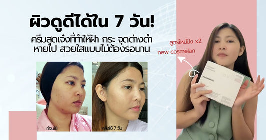 "ผิวดูดีได้ใน 7 วัน! ครีมสุดเจ๋งที่ทำให้ฝ้า กระ จุดด่างดำ หายไป สวยใสแบบไม่ต้องรอนาน"