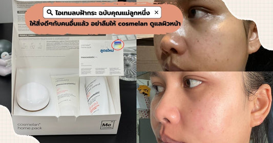 ไอเทมลบฝ้ากระ ฉบับคุณแม่ลูกหนึ่งการดูแลผิวหน้าด้วย Cosmelan (14 วัน)