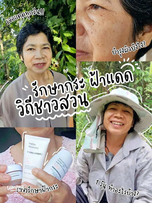 รักษาฝ้ากระ วิถีชาวสวน 🪴 เจอแดดทุกวัน! กระจะหายจริงเหรอ!?
